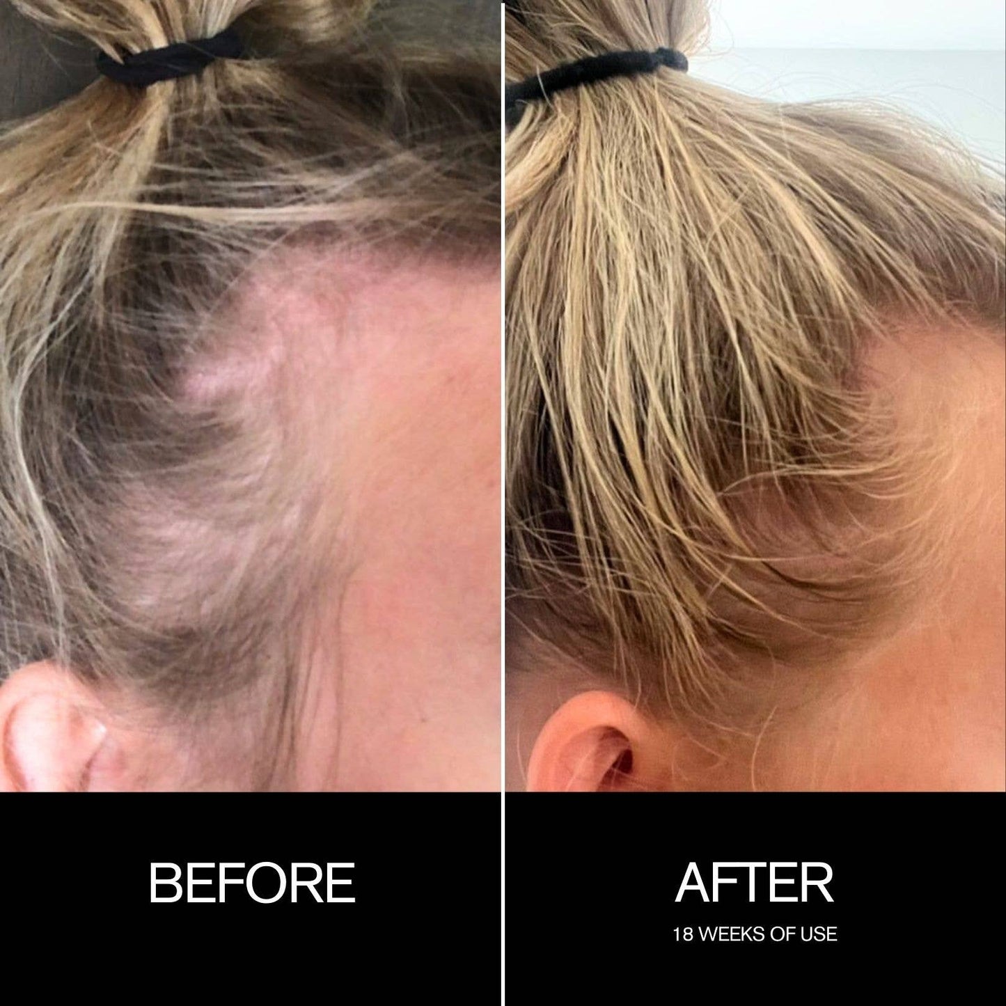 Follicle Drops Pre-Shampoo Scalp Oil