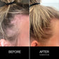 Follicle Drops Pre-Shampoo Scalp Oil